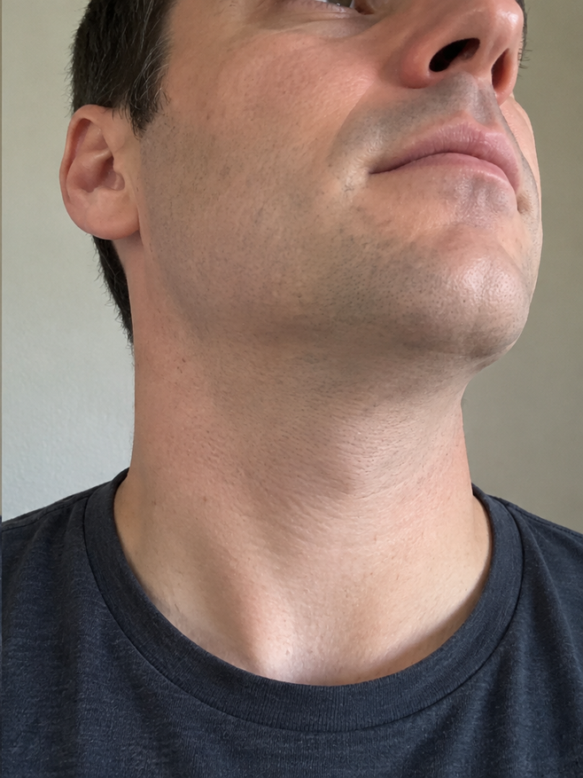 AFTER